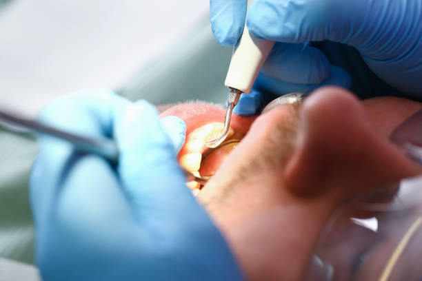 Best Pediatric Emergency Dentist in Floris, VA